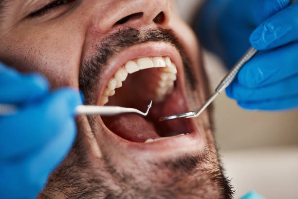 Best Emergency Treatment for Dental Infections or Abscesses in Southwest Greensburg, PA